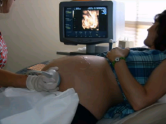 žena na ultrazvuku